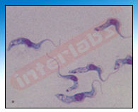 Trypanosoma gambiense, smear